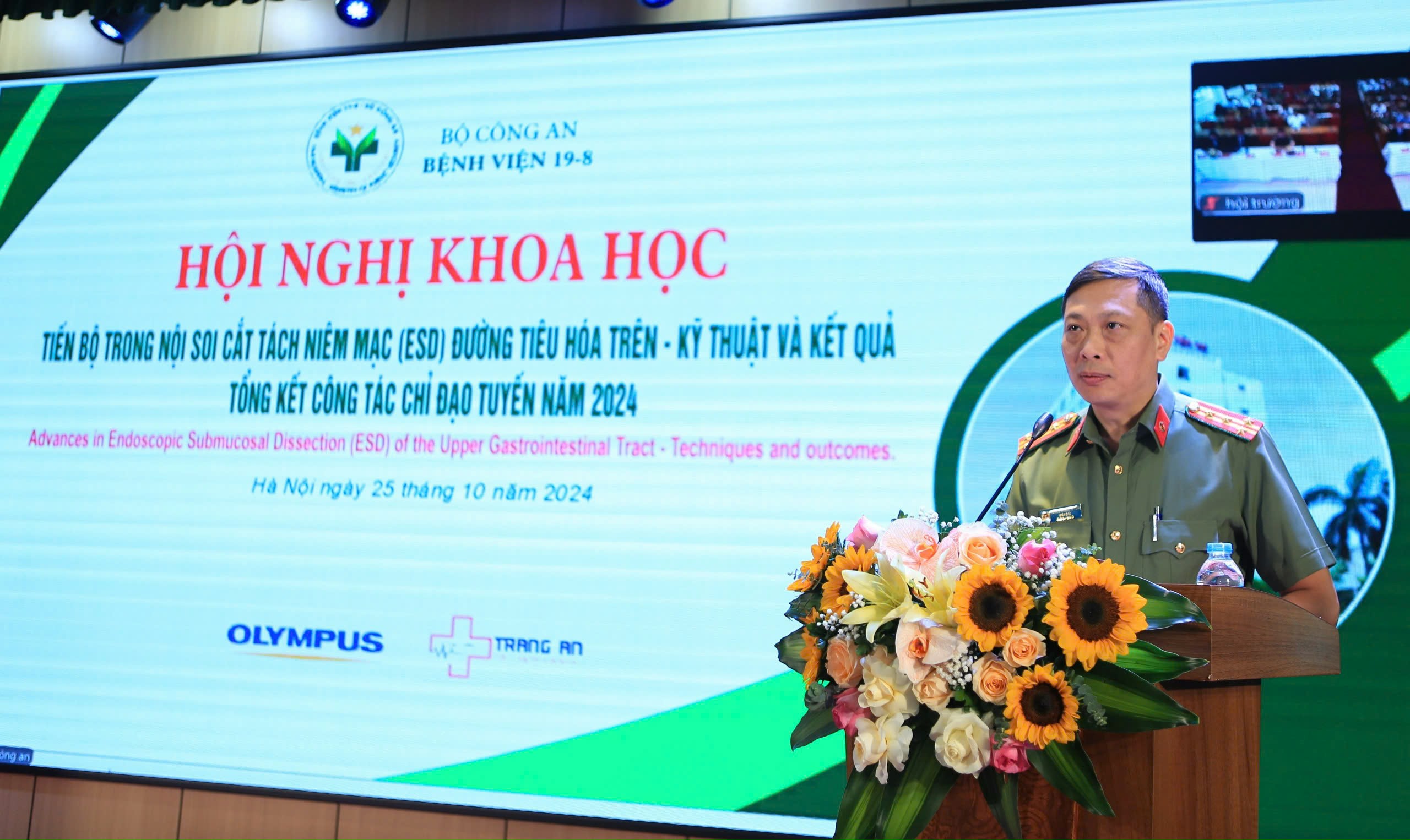 Dấu hiệu cảnh báo cần tầm soát ngay ung thư dạ dày- Ảnh 2. Dấu hiệu cảnh báo cần tầm soát ngay ung thư dạ dày- Ảnh 2.