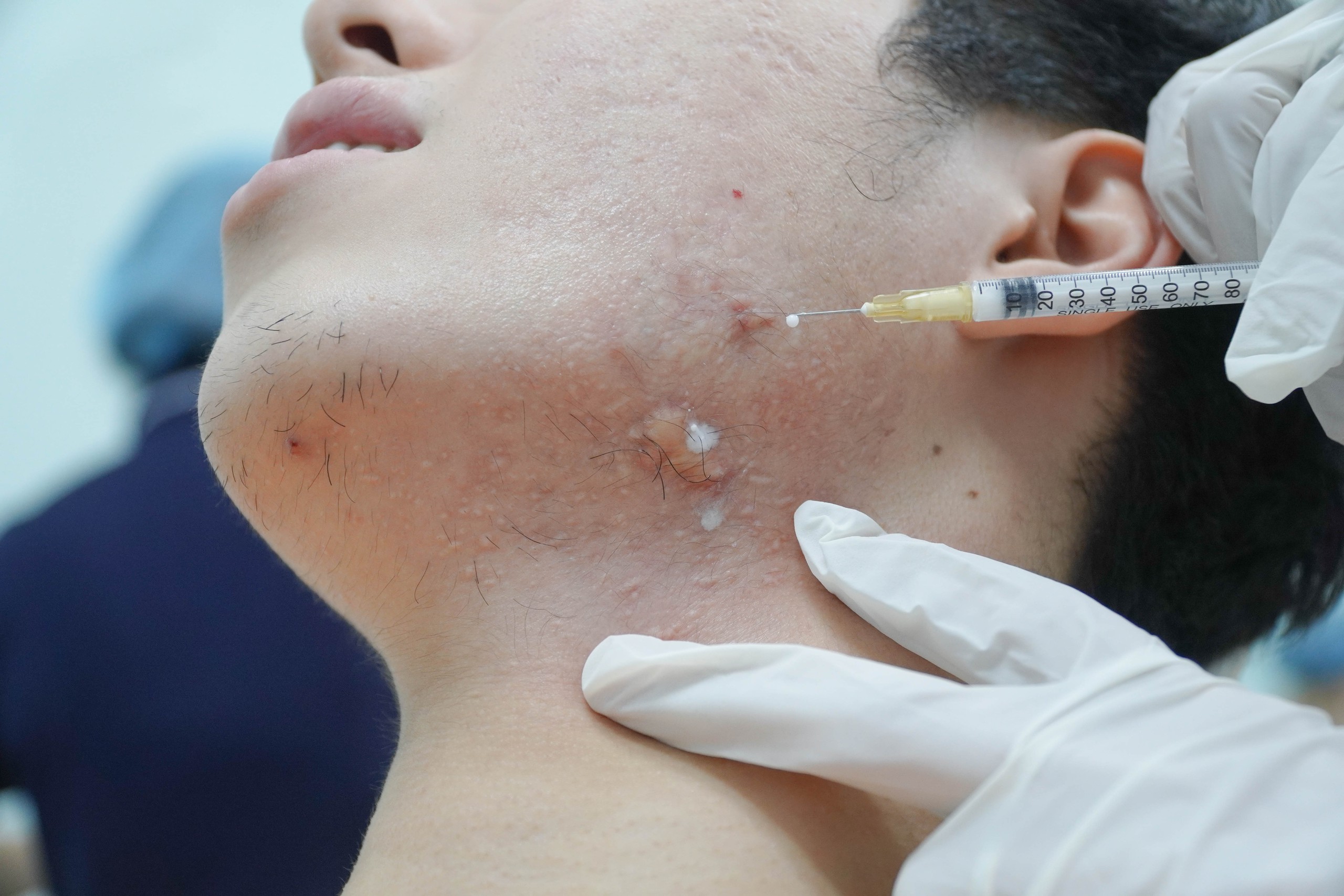 Nam giới chi mạnh tay để nâng cấp nhan sắc- Ảnh 3. Nam giới chi mạnh tay để nâng cấp nhan sắc- Ảnh 3.