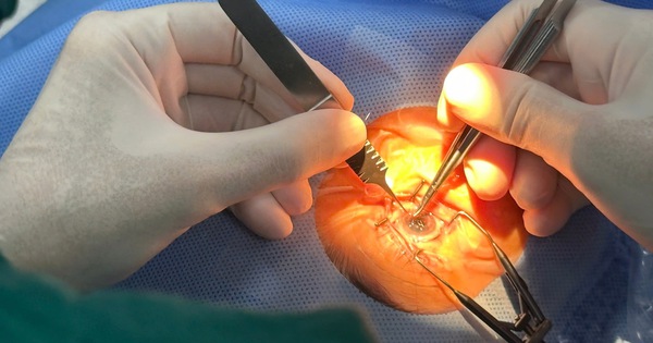 Hồi sinh thị lực nhờ nguồn giác mạc nhập khẩu 1 img4210 17290038743641333948595 320 0 1920 2560 crop 17290038808081494818138