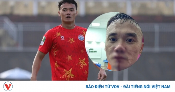 Nguyễn Xuân Nam và Vũ Văn Sơn chính thức nhận án kỷ luật nặng từ VFF vì đấm nhau 1 bia201 2