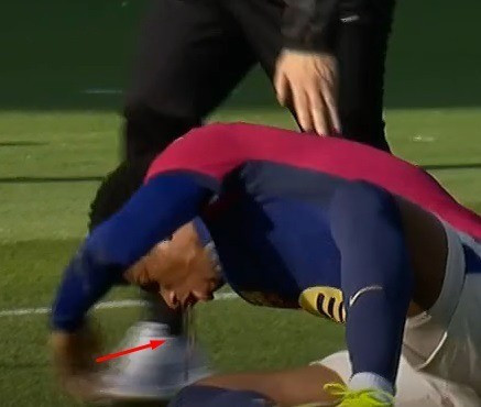Hậu vệ Alejandro Balde nôn ra máu barca01.jpg