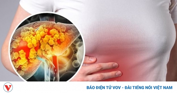 5 loại lá thảo dược là “khắc tinh”của gan nhiễm mỡ, ở Việt Nam cực nhiều 1 thao duoc dieu tri gan nhiem mo 1